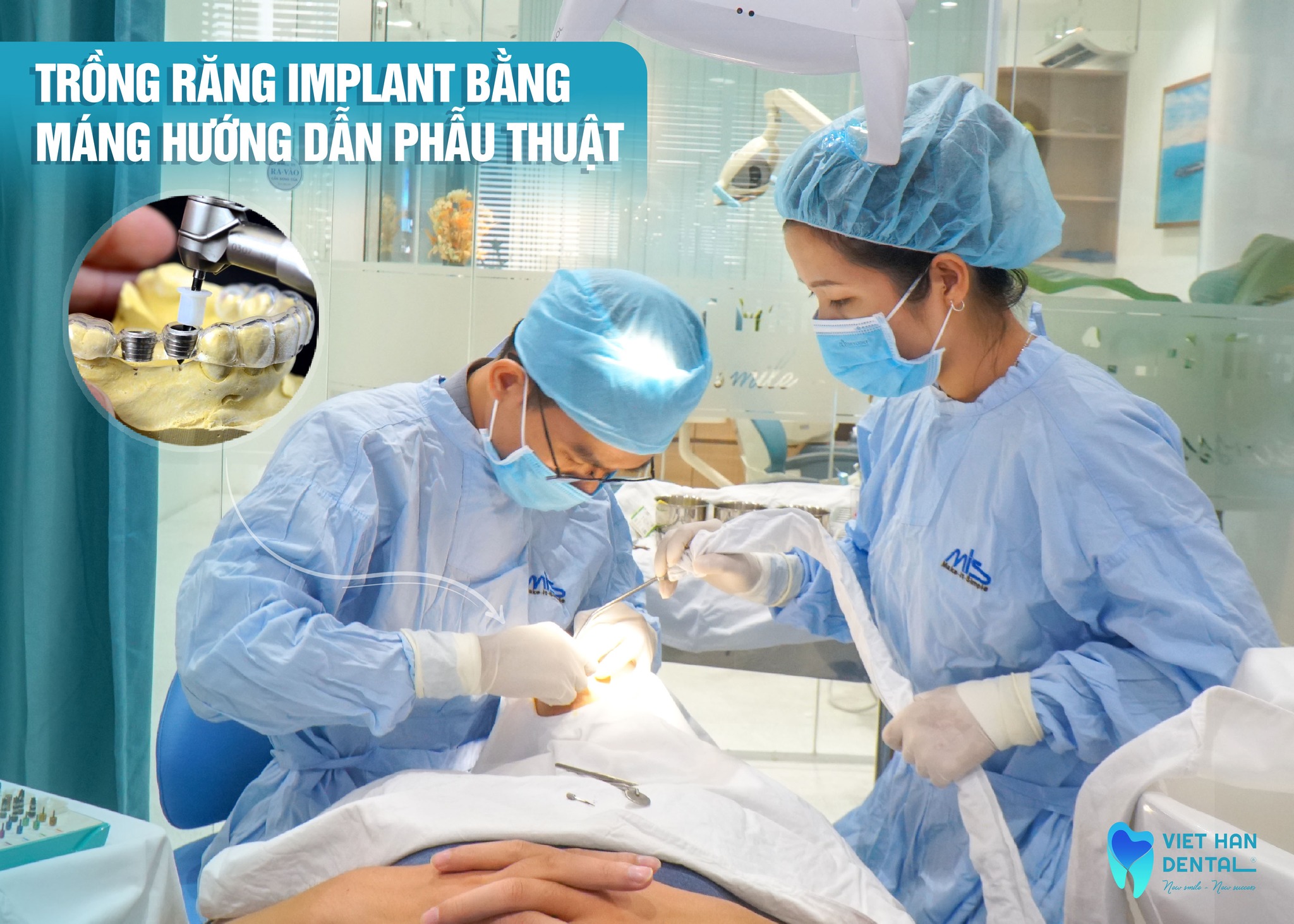 nha-khoa-trong-rang-implant-top-1-Nha-Trang