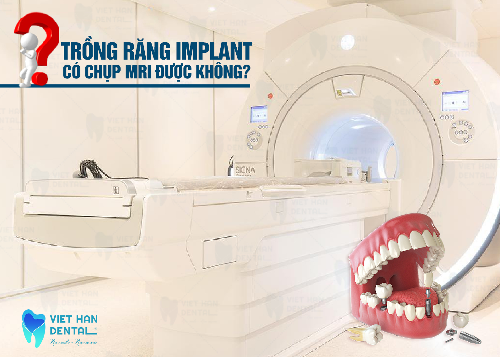 trong-rang-implant-co-chup-mri-duoc-khong