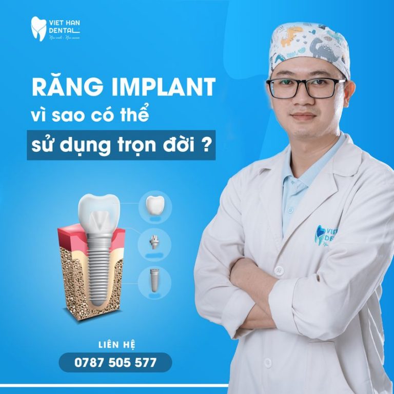 tuoi-tho-cua-tru-implant-la-bao-lau