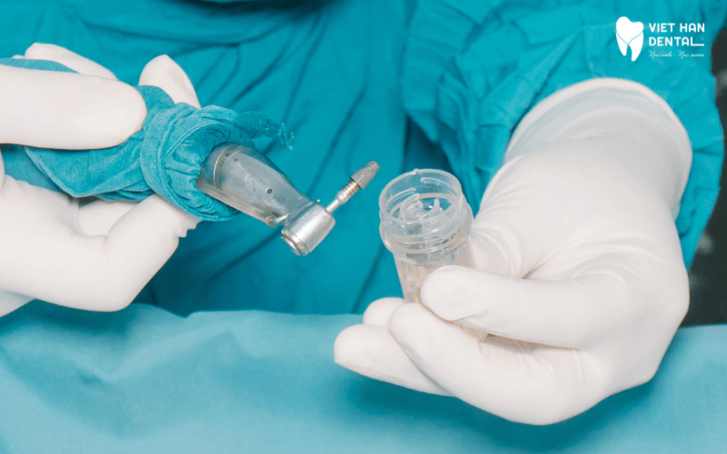 Đội ngũ bác sĩ trồng răng Implant tại Nhoa khoa Việt Hàn đều là chuyên gia trong lĩnh vực nha khoa