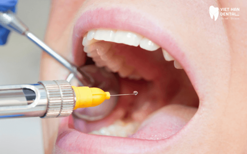 Tay nghề của bác sĩ là 1 trong các yếu tố quyết định mức độ thành công của ca cấy ghép Implant
