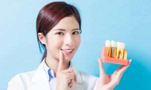 can-trong-bao-nhieu-tru-implant-cho-1-ham-thi-moi-chac-chan