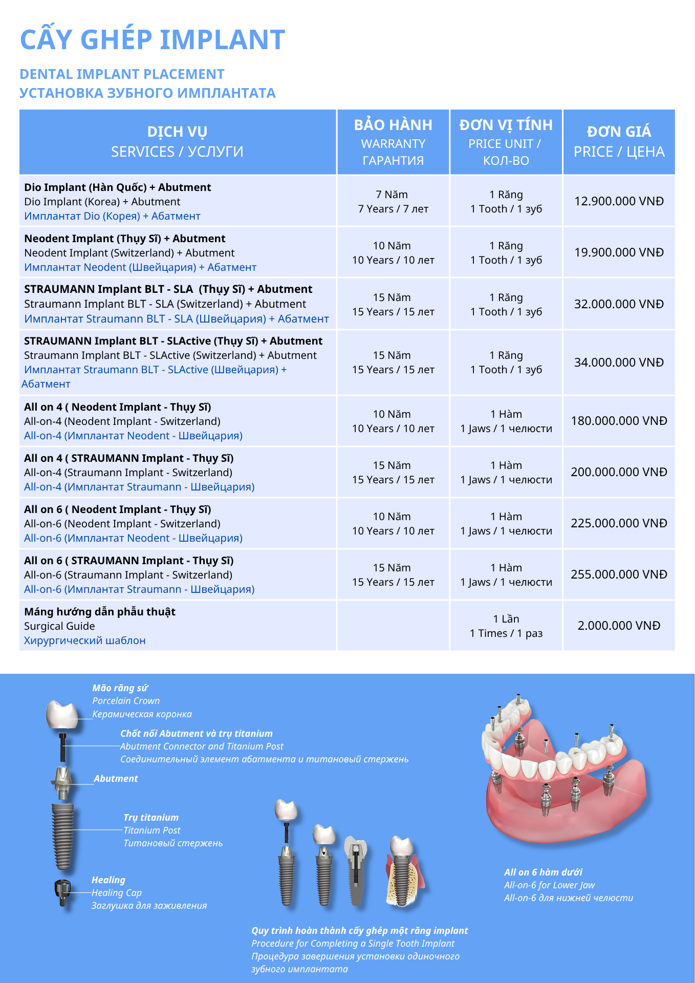 Bảng giá Implant