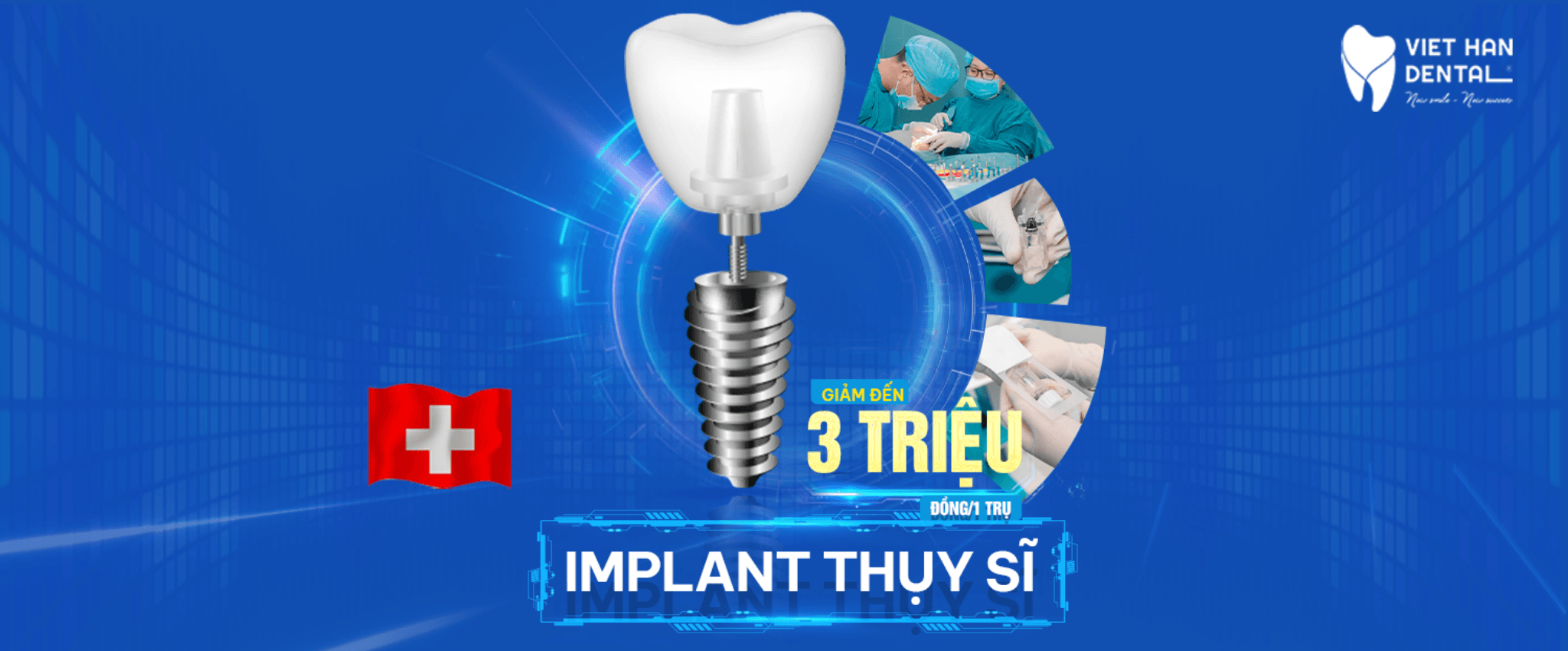 Cover webiste implant